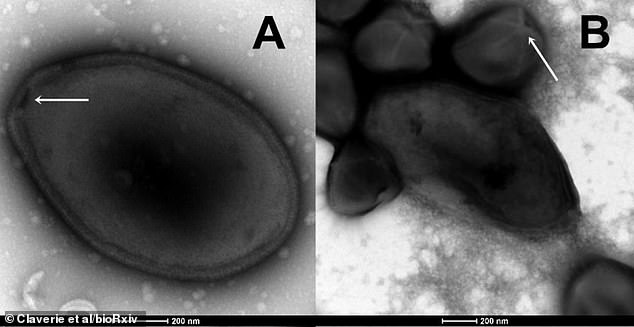 الفيروس البالغ من العمر 48500 عام هو فيروس باندورا ، الذي يصيب الكائنات أحادية الخلية المعروفة باسم الأميبا.  تُظهر الصورة أ الجسيم المعزول على شكل بيضة لفيروسات باندورا مع ثقب صغير أو فتحة تسمى ostiole (رأس السهم الأبيض).  يُظهر B مزيجًا من جزيئات pandoravirus وجزيئات `` megavirus '' مع `` stargate '' - بنية تشبه نجم البحر الأبيض (رأس السهم الأبيض)